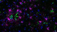 immunofluorescence image of microglia cells